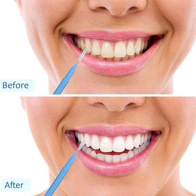 Patelai 100 Pieces Braces Brush for Cleaner Interdental Brush Toothpick Dental Tooth Flossing Head Oral Dental Hygiene Flosser Toothpick Cleaners Tooth Cleaning Tool (Classic)